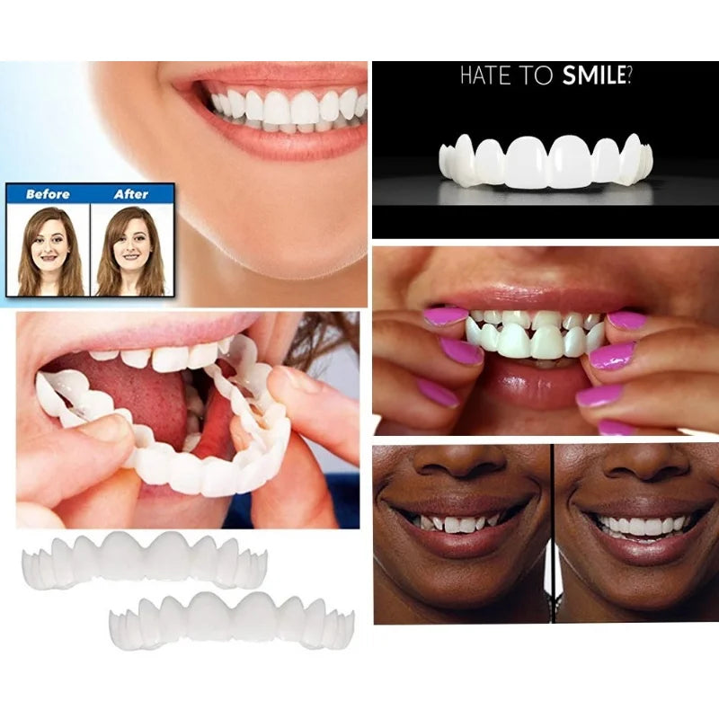 Upper & Lower Teeth Veneers Anti-true Braces Snap On Smile Teeth Whitening Denture Teeth Comfortable Veneer Cover Teeth
