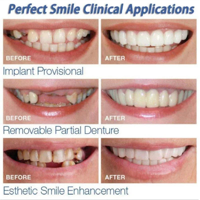Upper & Lower Teeth Veneers Anti-true Braces Snap On Smile Teeth Whitening Denture Teeth Comfortable Veneer Cover Teeth