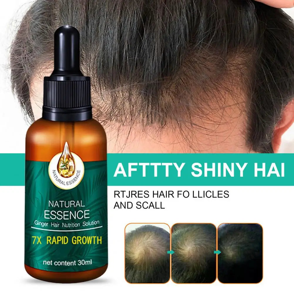 Ginger Anti-Hair Loss Essential Oil Dredges Hair Follicles Hair Growth Serum Hair Treatement Oil