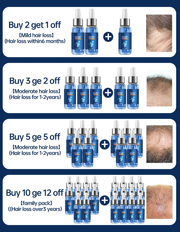 Fast Hair Growth Hair Growth Oil Effective Baldness Repair Hereditary Hair Loss Postpartum Hair Loss Seborrheic Hair Anti Loss