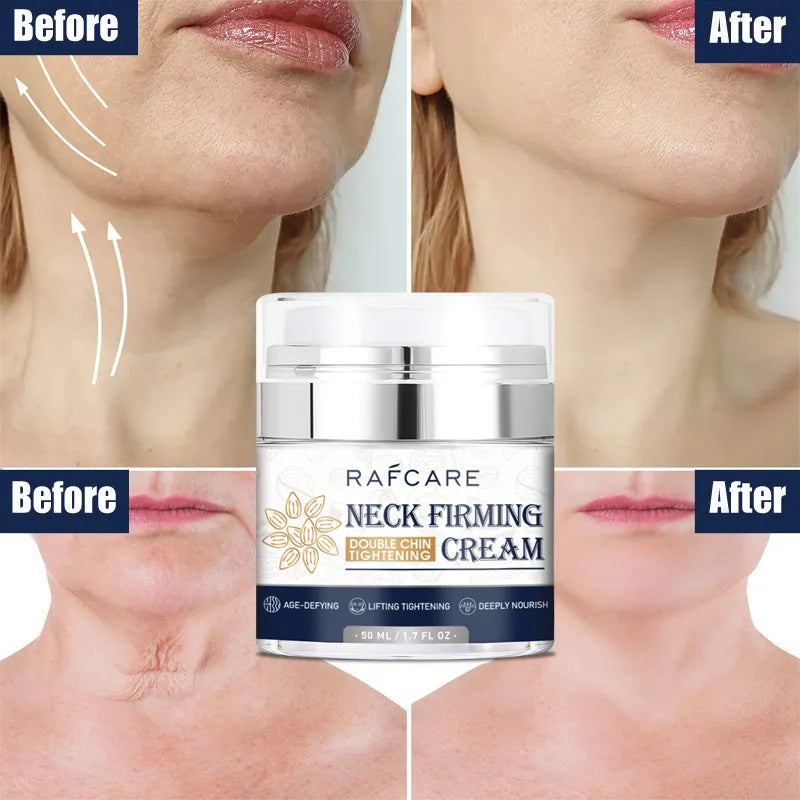 Instant Neck Face Firming Cream Collagen Hyaluronic Acid Lifting Double Chin Reducer Neck Tightener Cream Whitening Skin Product