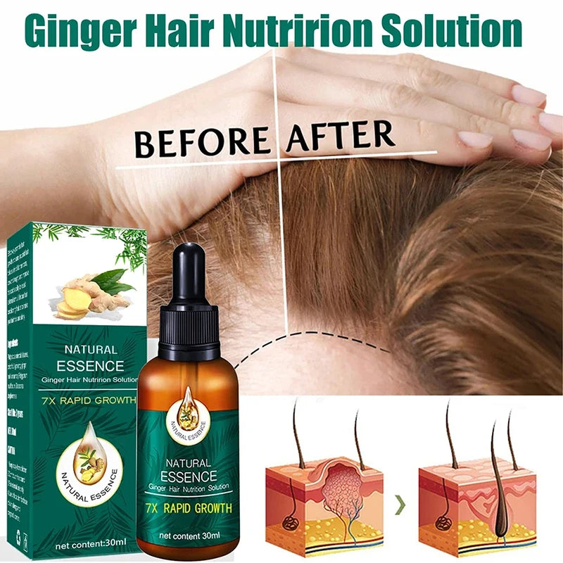 Hair Fast Growth Hair Care Essential Oil Natural Ginger Hair Regrowth Products Serum Hair Care Anti Hair Loss Series 2024