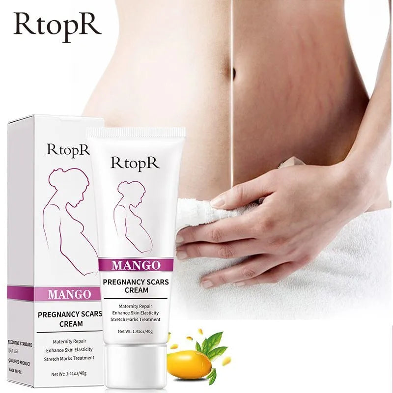 Mango Remove Pregnancy Scars Acne Cream Stretch Marks Treatment Maternity Repair Anti-Aging Anti-Winkles Firming Body Creams