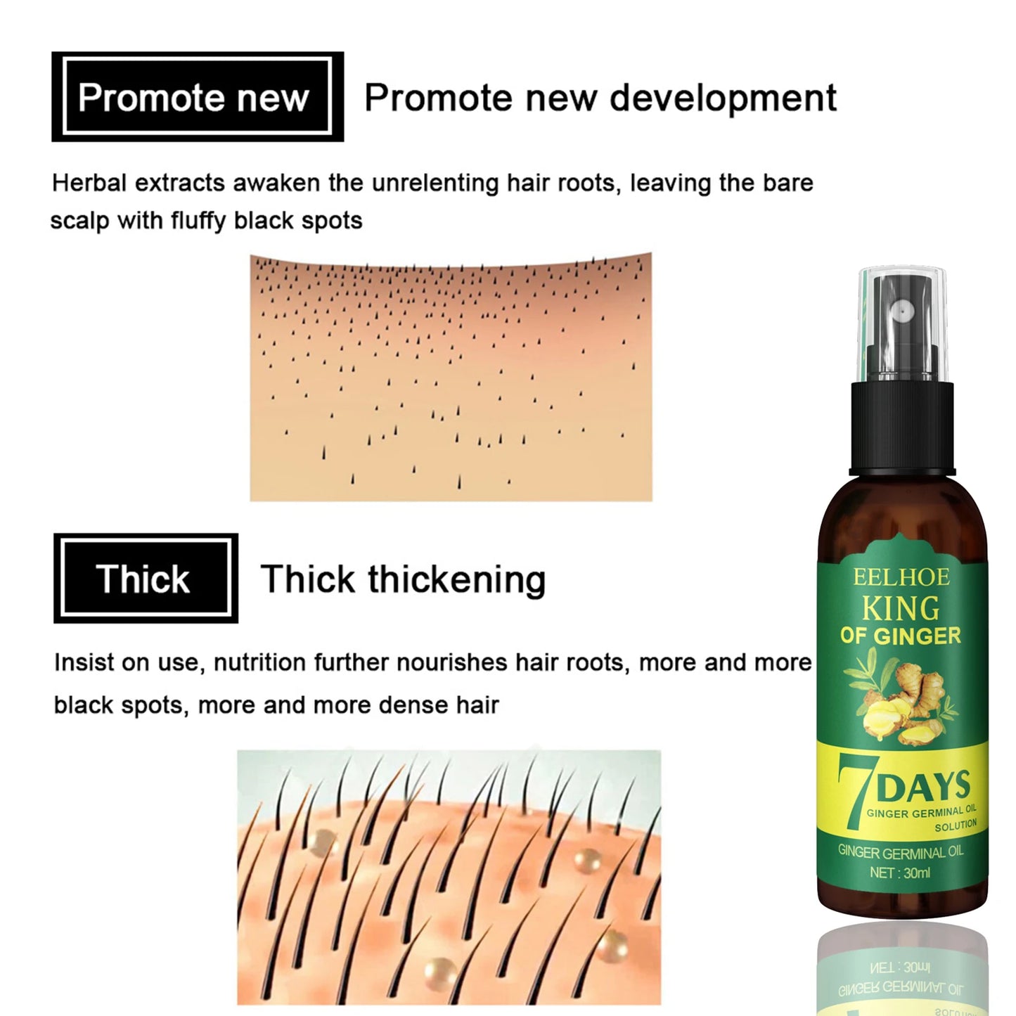 Ginger Hair Growth Serum Sprayer Hair Regrowth s Grow Thicker Longer Hair Accelerate Hair Growth For Men And Women