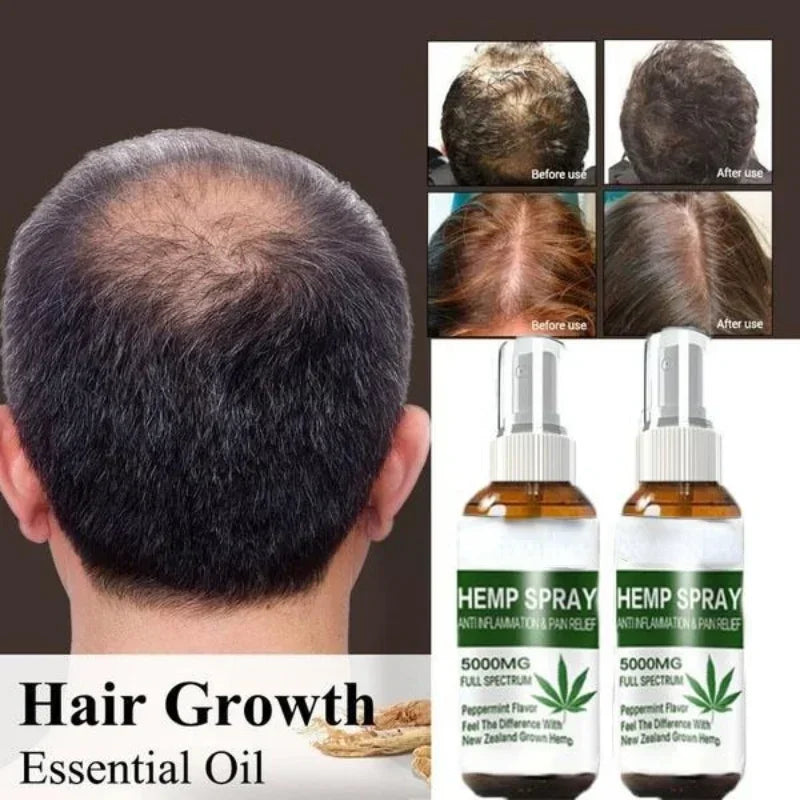 TRSTAY Hair Spray Hairloss Hair Tools Rosemary Oil for Hair Professional Brazilian Keratin New Hair Growth Essence Care Products