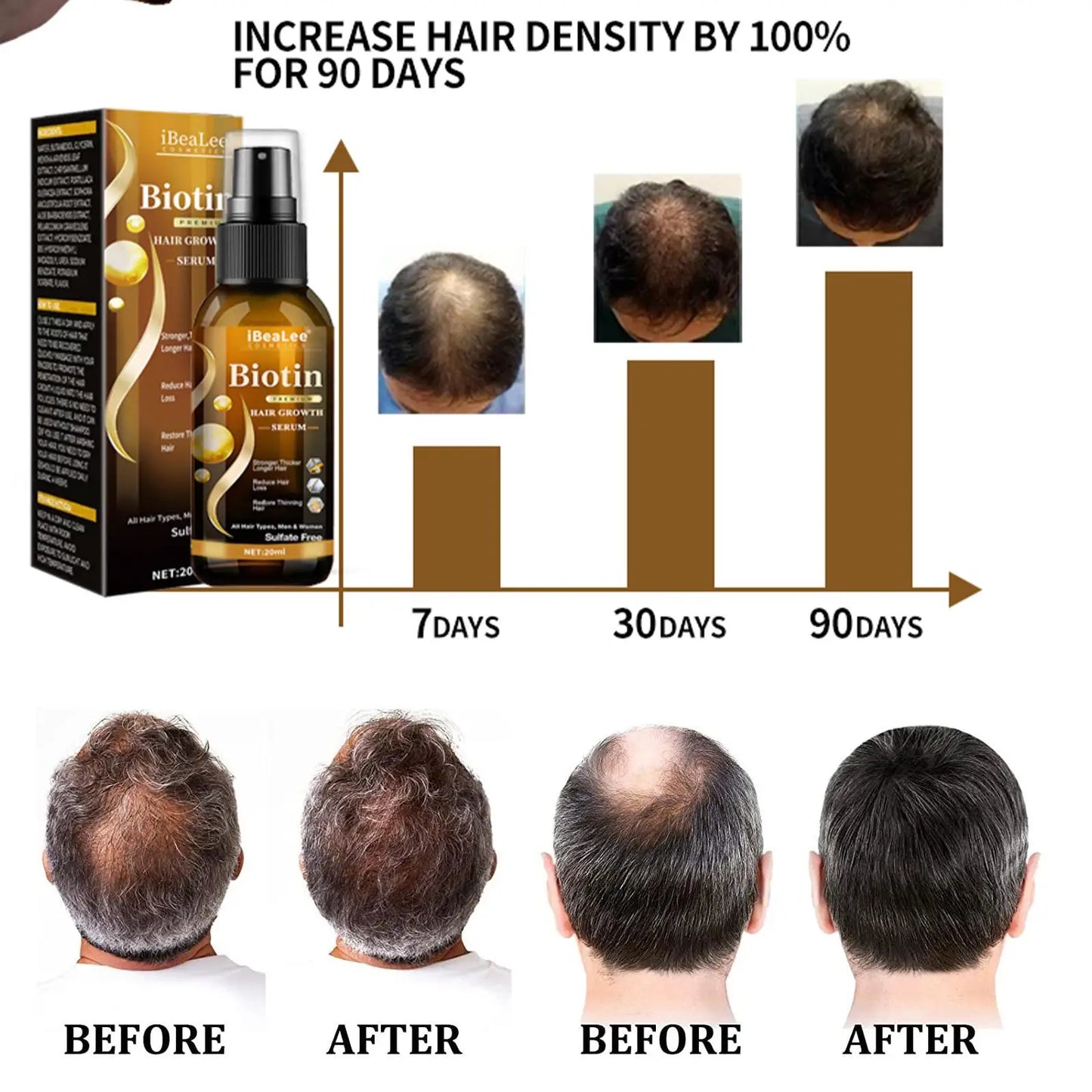 Fast Spray Products Anti Hair Loss Serum Prevent Baldness Treatment Scalp Dry Damaged Beard Hair Care Essential Oils