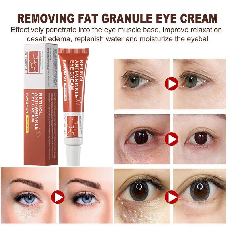 Retinol Anti-Wrinkle Eye Cream Remove Eye Bags Puffy Reduce Wrinkles Fine Lines Cream Face Neck Anti Aging Skin Care Products