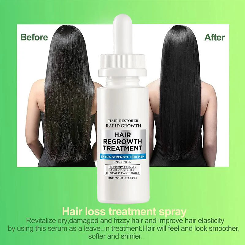 Women Ginger Hair Growth Essence Oils Products Anti Hair Loss Treatement Fast Growing Germinal Serum Prevent Scalp Damaged Men