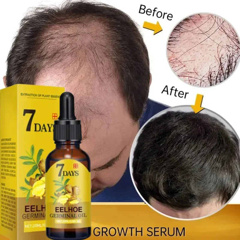 7 Days Ginger Hair Growth Serum Fast Promote Hair Regrowth Products Anti Hair Loss Scalp Treatment Baldness Care Essential Oils