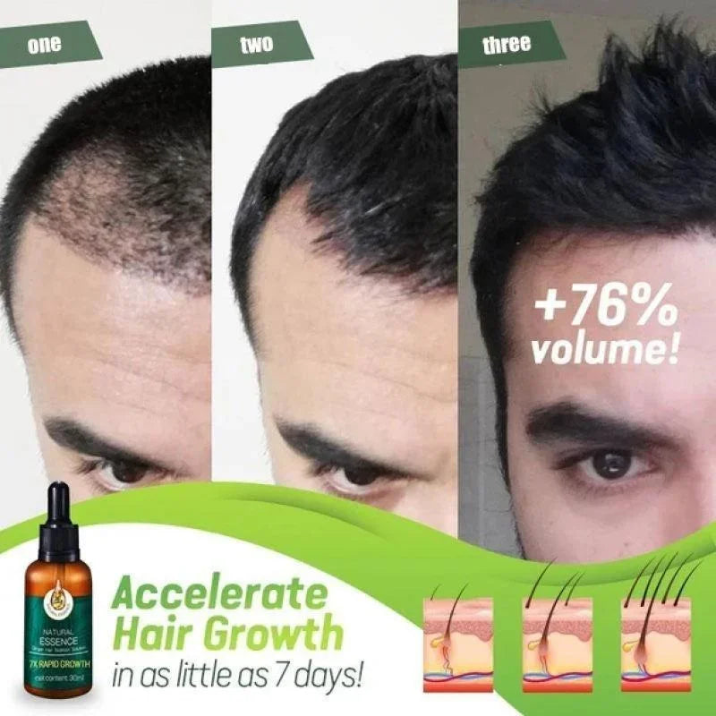 Hair Rapid Growth Essential Oil Health Care Head Beauty Effective Anti Hair Loss Thick Eyebrows Eyelashes Essence