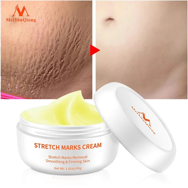 Pregnancy cream Removes Maternal Skin Repair Body Cream Removes Postpartum Scar Care Gentle Moisturizing Smooth skin