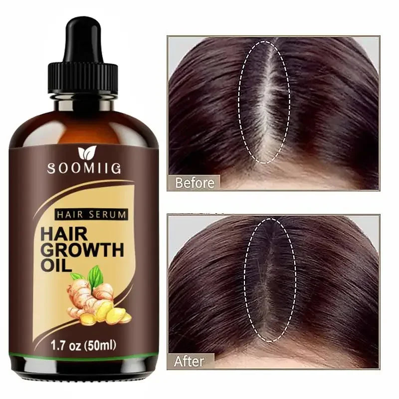 Powerful Hair Growth Oil Prevent Hair Loss Products Essence Liquid Treatment For Men And Women Repair Shampoo Hair Care 50ml