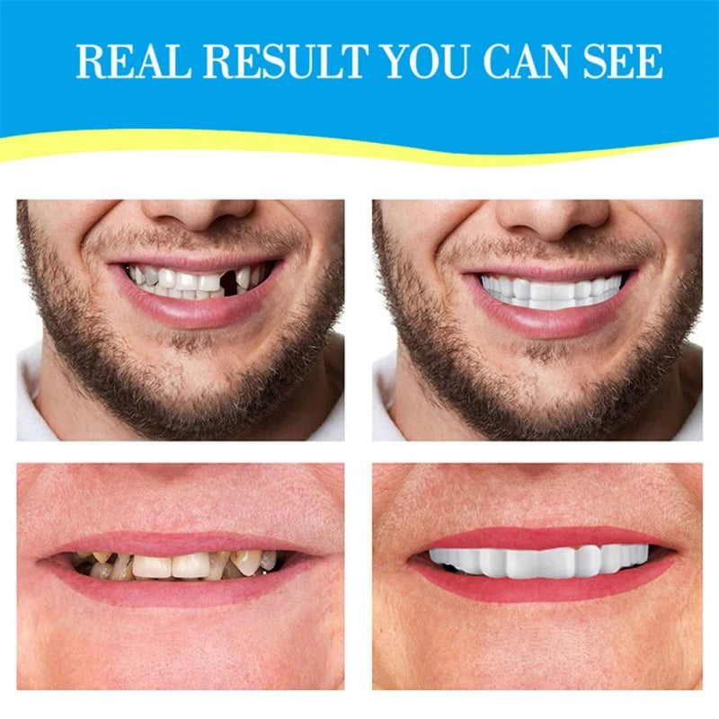 Easy to Use  Veneer Snap-on Teeth Complete Your Smile for Men And Women Temporary Tooth Replacement Product Fake Teeth