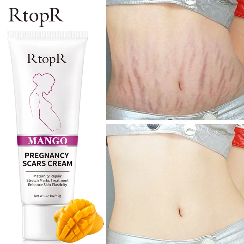 RtopR Pregnancy Scar Removal Cream Pregnant Women Pigment Correction Repair Body Gel Firming and Brightening Stretch Marks 40g