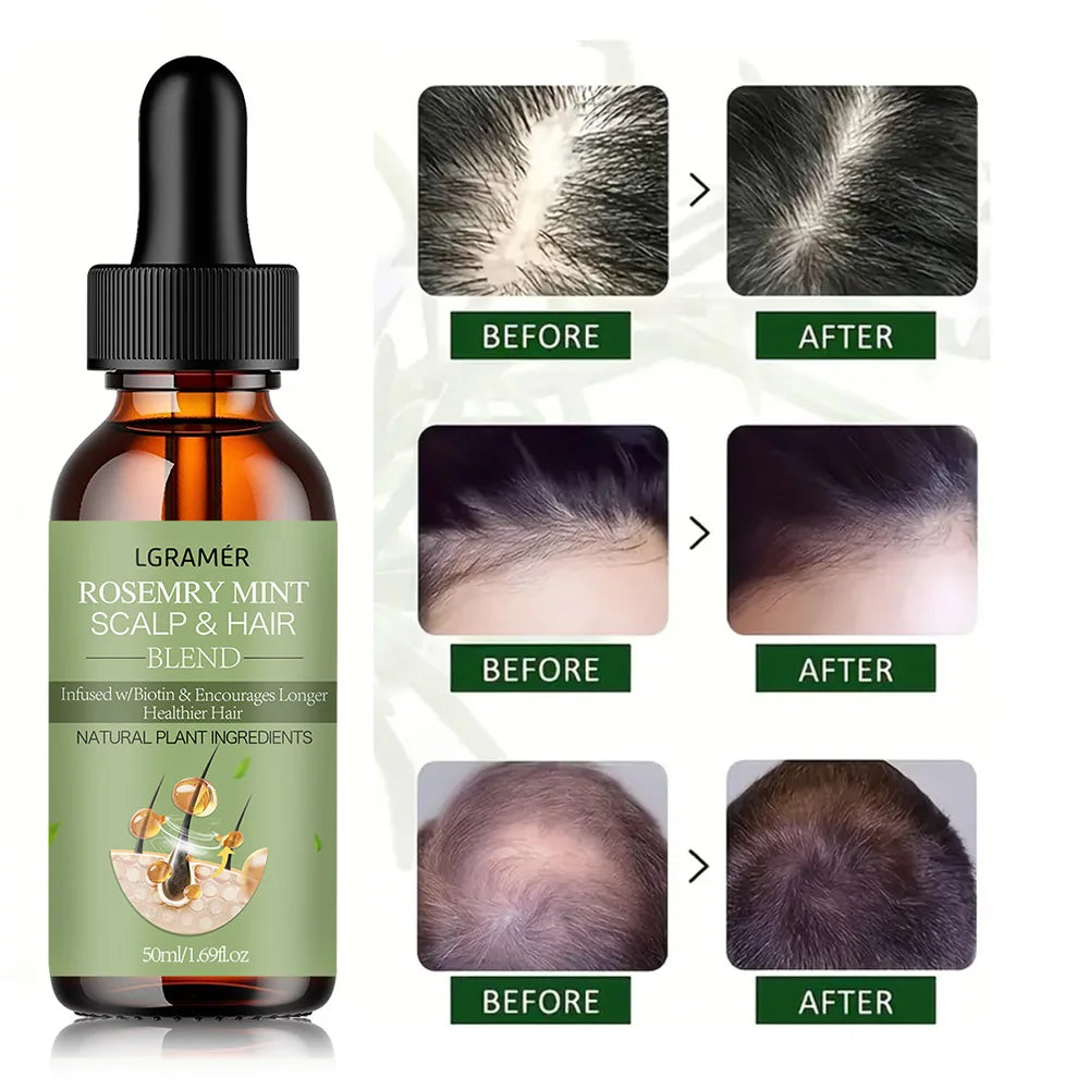 Hair Growth Essential Oil Rosemary Mint Hair Strengthening Oil Nourishing Treatment For Split Ends Dry Organics Hair Care Oil