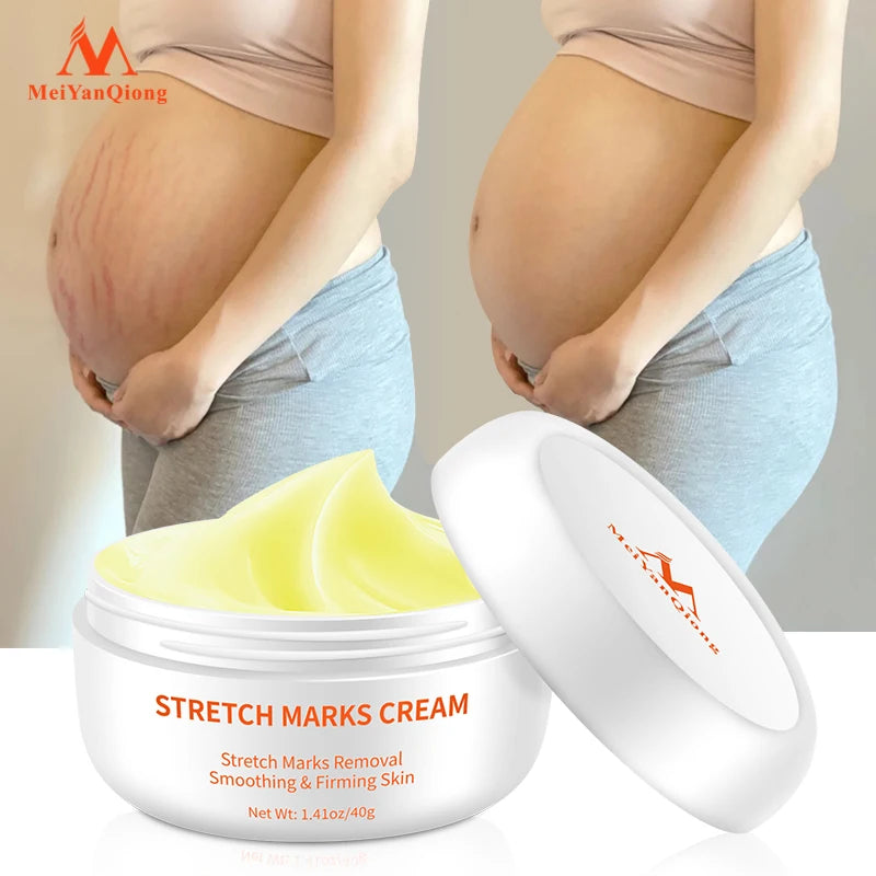 Pregnancy cream Removes Maternal Skin Repair Body Cream Removes Postpartum Scar Care Gentle Moisturizing Smooth skin