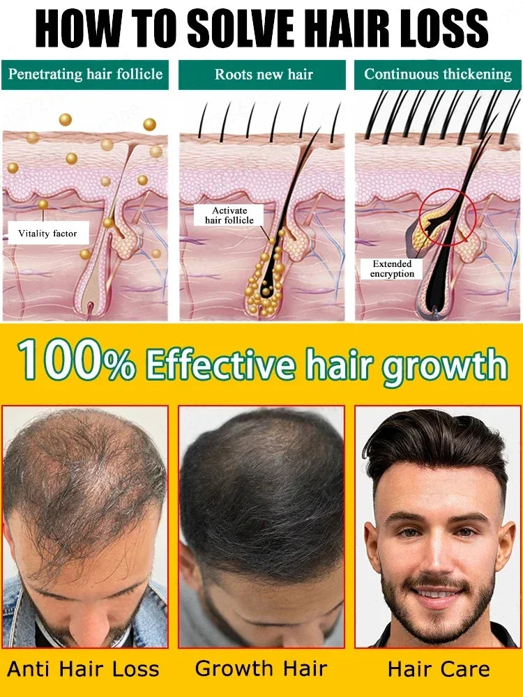 Biotin Hair Growth Products for Man Women Anti Hair Loss Ginger Serum Fast Regrowth Oil Hair Oil for Fast Growth Essentials