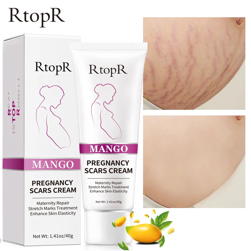 RtopR Pregnancy Scar Removal Cream Pregnant Women Pigment Correction Repair Body Gel Firming and Brightening Stretch Marks 40g