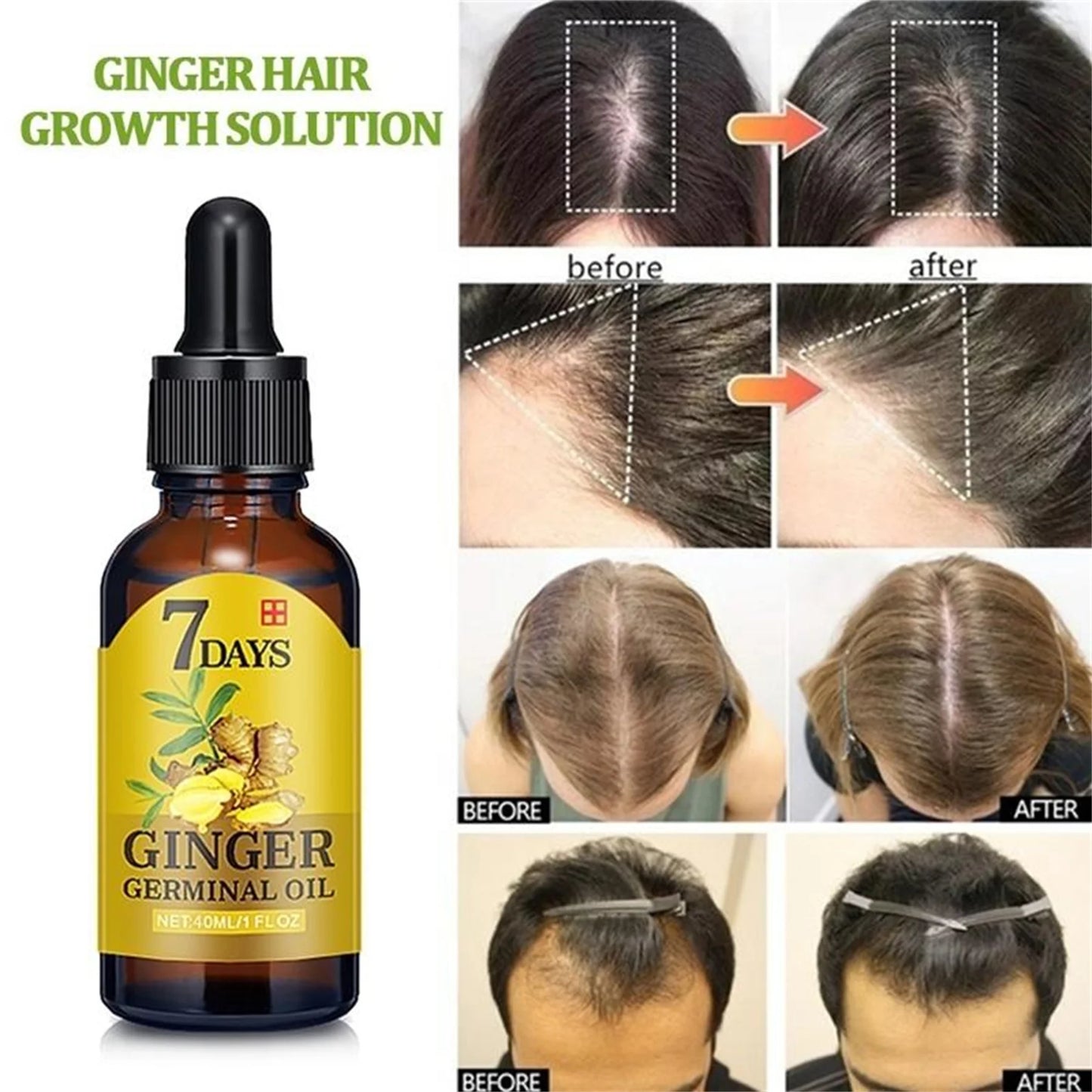 Hair Growth Serum Anti Preventing Hair Loss Alopecia Liquid Damaged Hair Repair Growing Faster