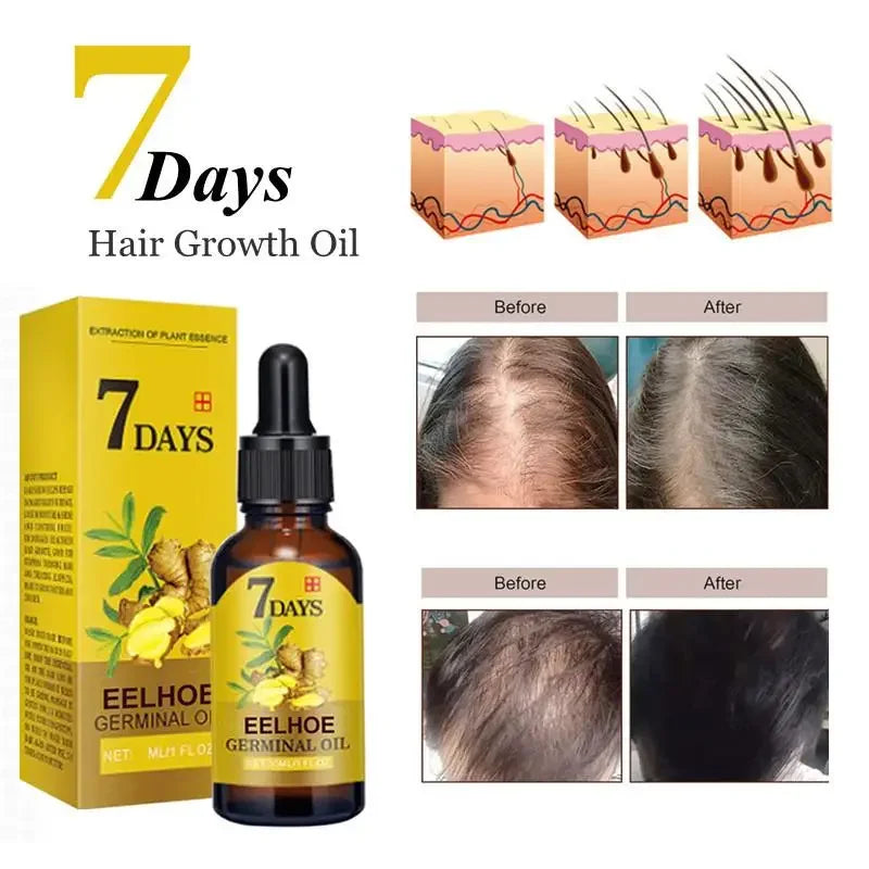 7 Days Ginger Hair Growth Serum Fast Promote Hair Regrowth Products Anti Hair Loss Scalp Treatment Baldness Care Essential Oils