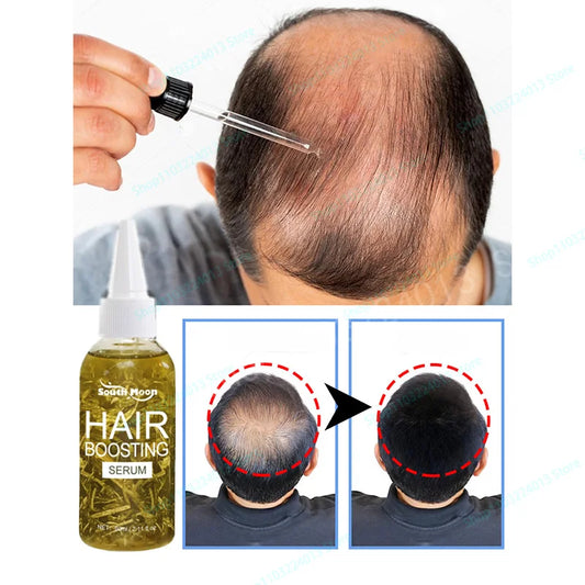 Unisex Hair Growth Oil Hair Loss Treatment Rapid Hair Growth Effective Baldness Repair Hereditary Postpartum Hair Loss