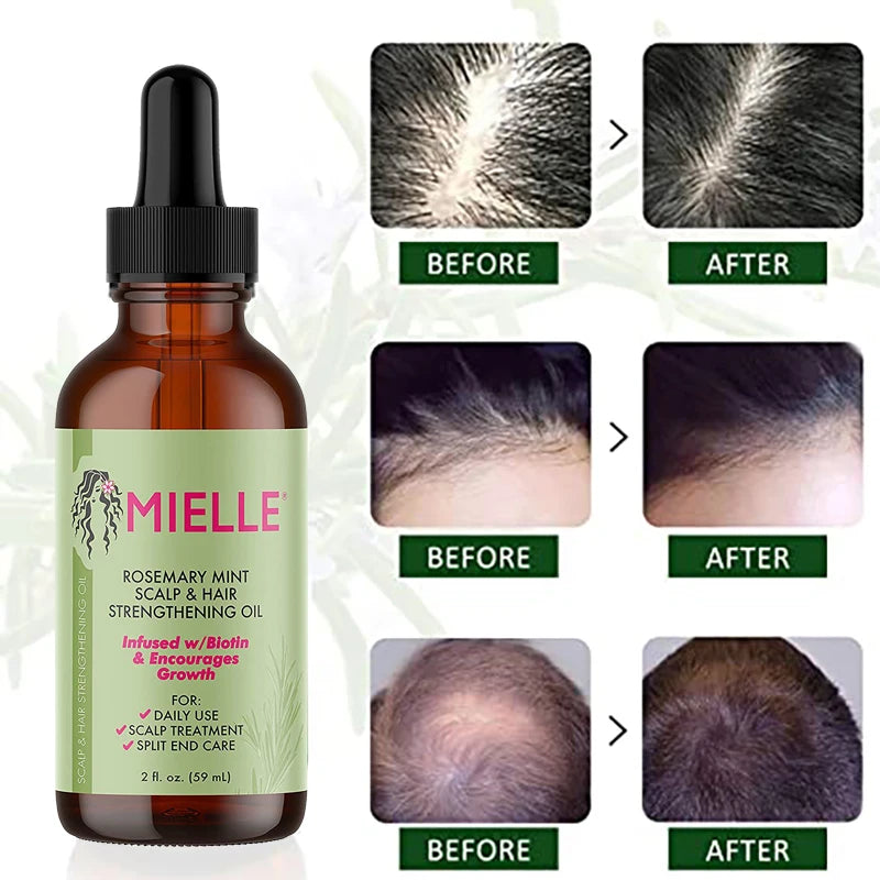 Hair Growth Essential Oil Rosemary Mint Hair Strengthening Oil Treatment  Dry Mielle Organics Split Ends Hair Essential Oil