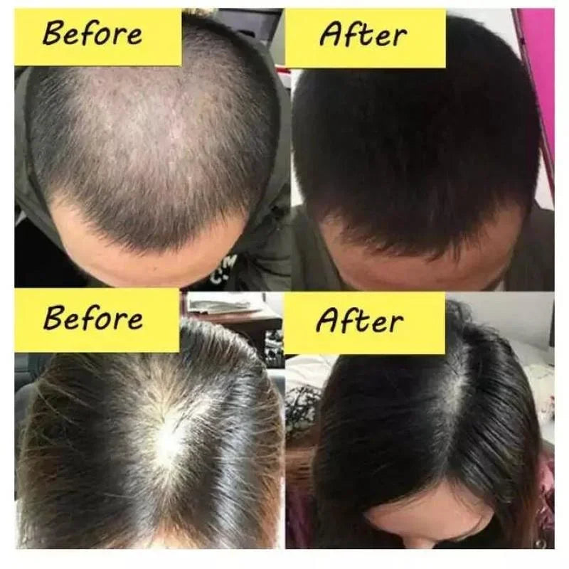 Hair Rapid Growth Essential Oil Health Care Head Beauty Effective Anti Hair Loss Thick Eyebrows Eyelashes Essence