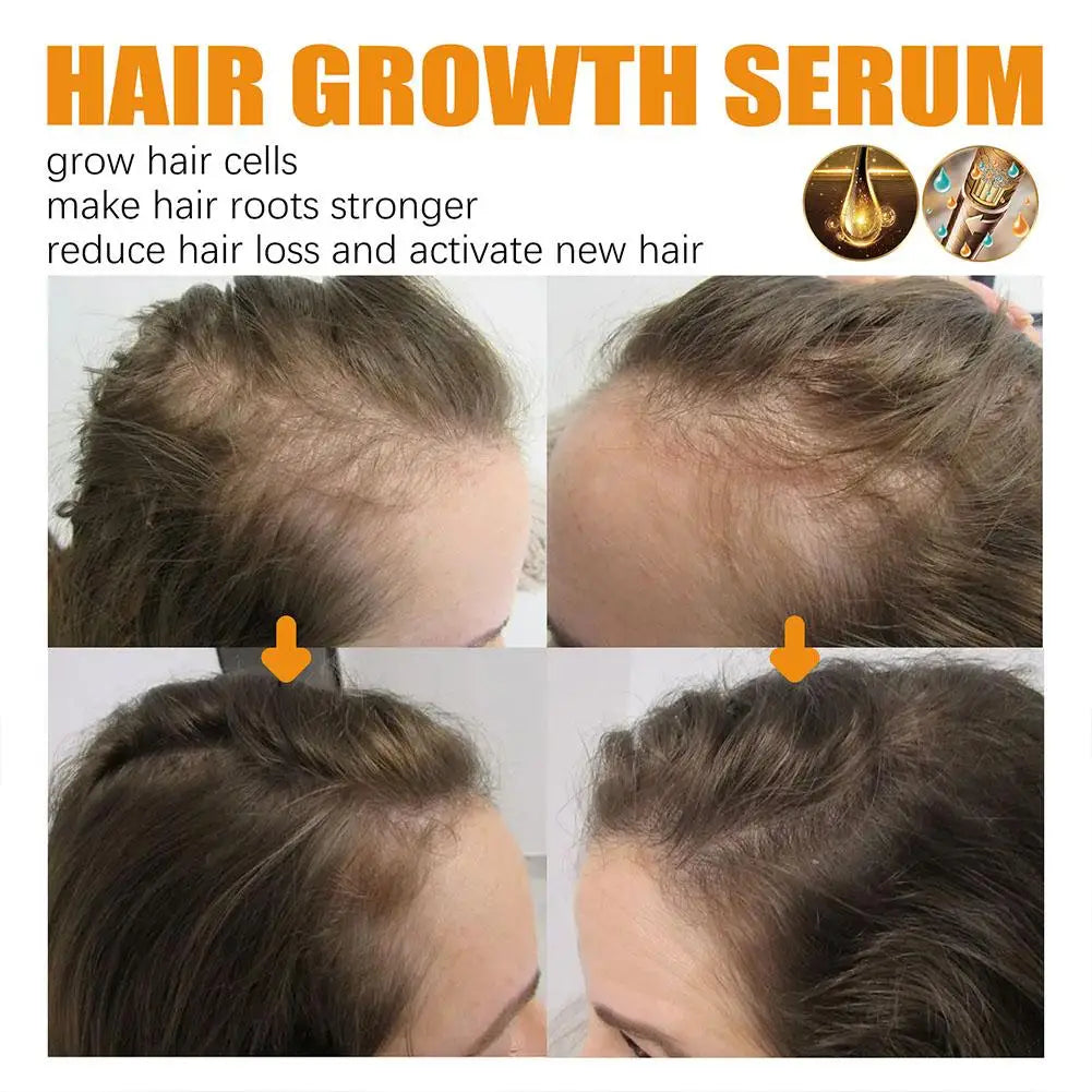 30ml EELHOE Biotin Hair Growth For Man Women Anti Hair Loss Oil Scalp Treatment Serum Spray Thicken Fast Regrowth Hair Care