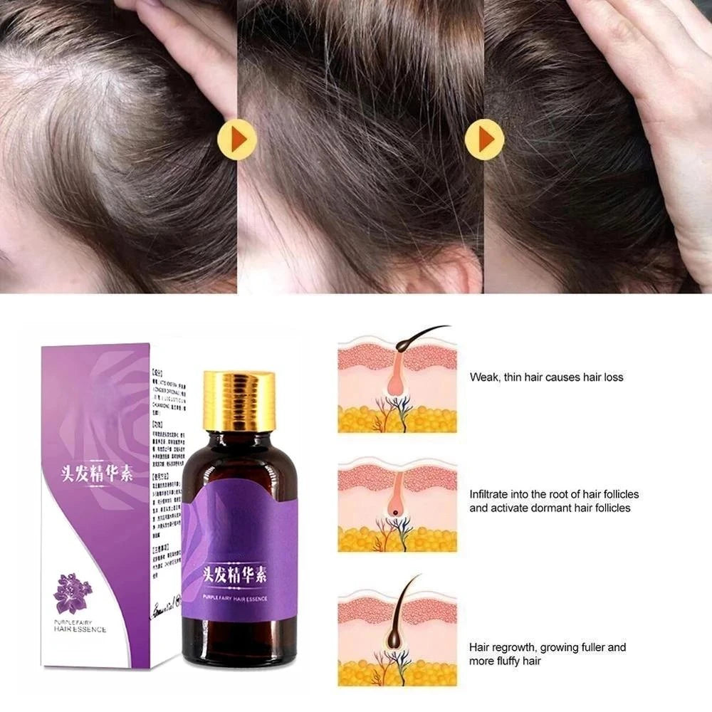 Hair Growth Products Ginger Fast Growing Hair Essential Oil Beauty Hair Care Prevent Hair Loss Oil Scalp Treatment For Men Women