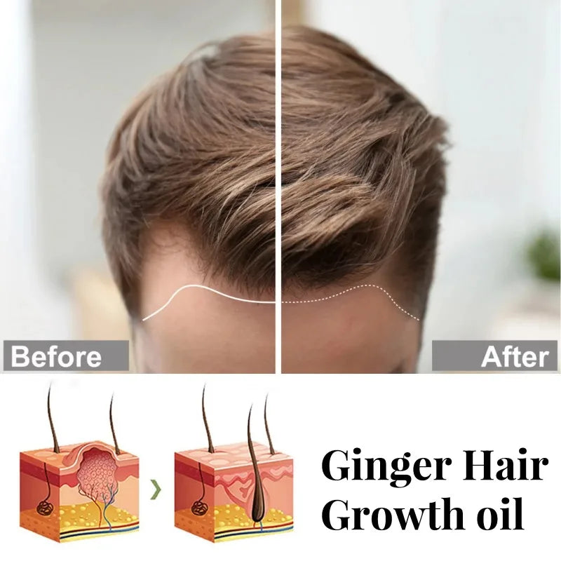 Ginger Hair Growth Spray Anti Hair Loss Serum Treatment Dry Frizzy Damaged Thin Hair Nourish Essential Oil Beauty Hair Care 30ml