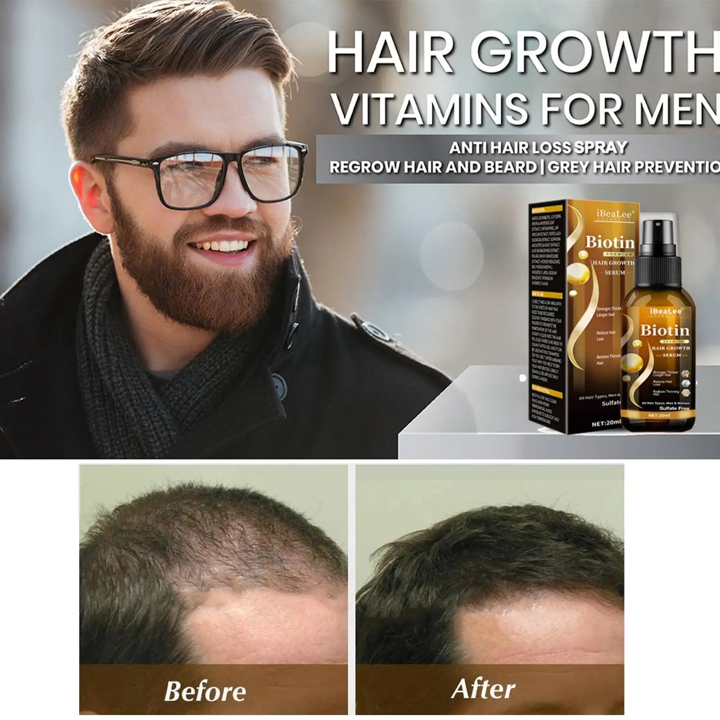 Fast Spray Products Anti Hair Loss Serum Prevent Baldness Treatment Scalp Dry Damaged Beard Hair Care Essential Oils