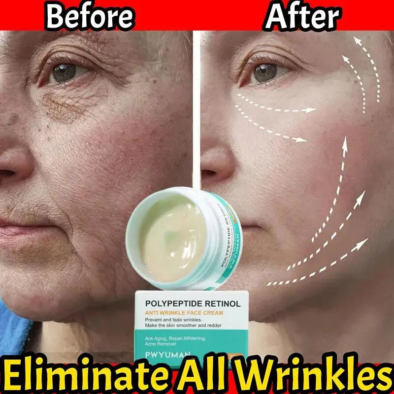 Retinol Remove Wrinkle Cream Instant Anti-Aging Fade Fine Line Firming Lifting Moisturizing Smooth Repair Dry Skin Care Products