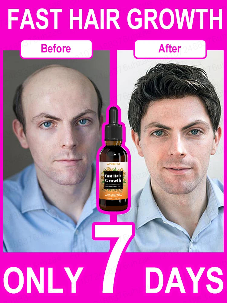 Unisex Hair Growth Oil Hair Loss Treatment Rapid Hair Growth Effective Baldness Repair Hereditary Postpartum Hair Loss