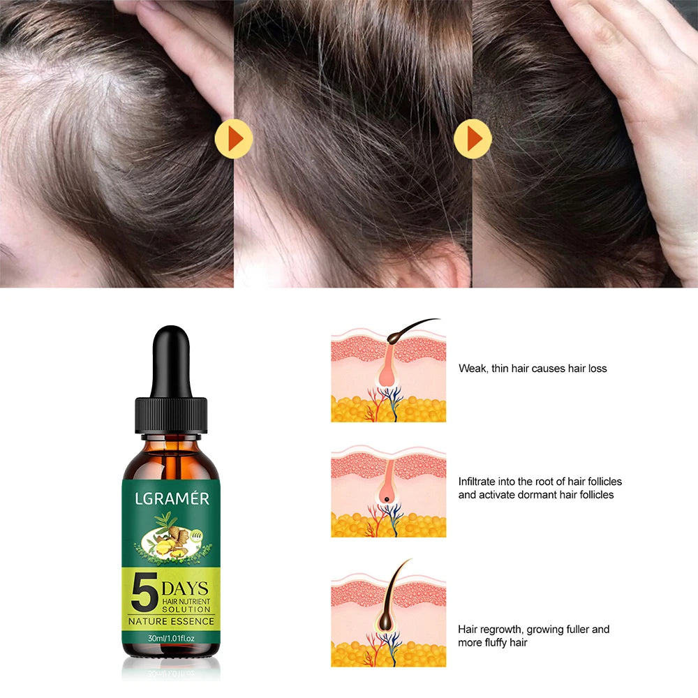 Hair Growth Essence Oil 5 Days Ginger Hair Growth Oil Anti Hair Loss Prevent Baldness Treatment Fast Nourish Scalp Hair Care