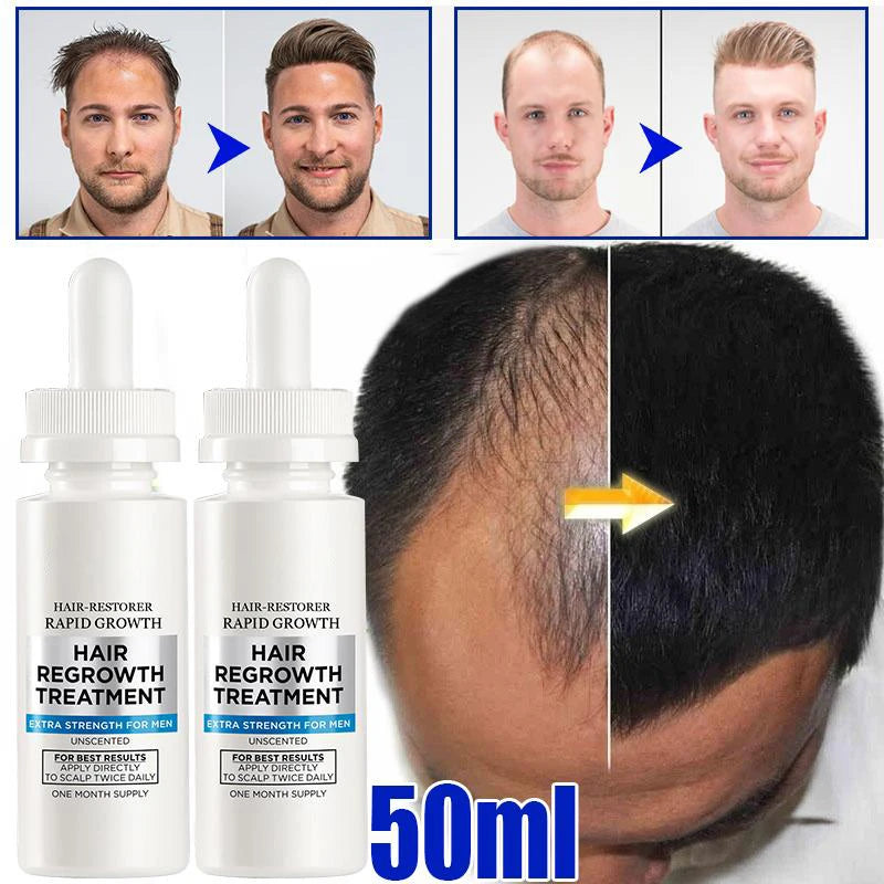 Women Ginger Hair Growth Essence Oils Products Anti Hair Loss Treatement Fast Growing Germinal Serum Prevent Scalp Damaged Men