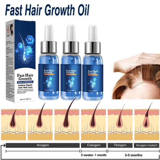 Fast Hair Growth Hair Growth Oil Effective Baldness Repair Hereditary Hair Loss Postpartum Hair Loss Seborrheic Hair Anti Loss