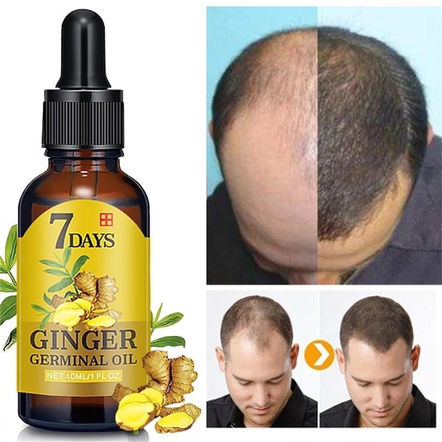 Hair Growth Serum Anti Preventing Hair Loss Alopecia Liquid Damaged Hair Repair Growing Faster