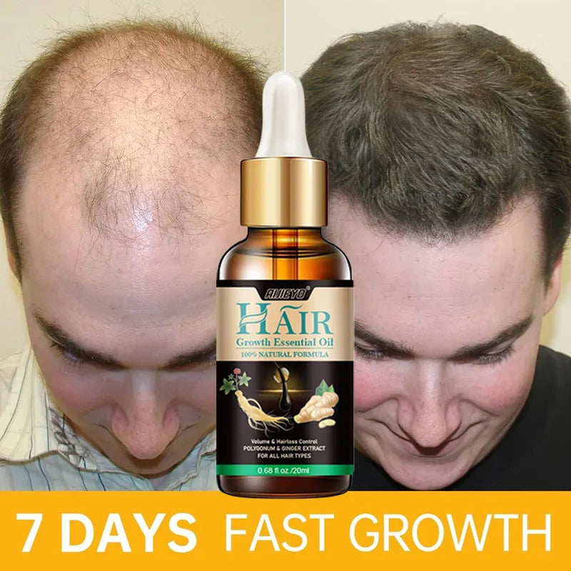 7 Days Ginger Hair Growth Products Natural Anti Hair Loss Prevent Baldness Treatment Fast Growing Nourish Dry Damaged Hair Care