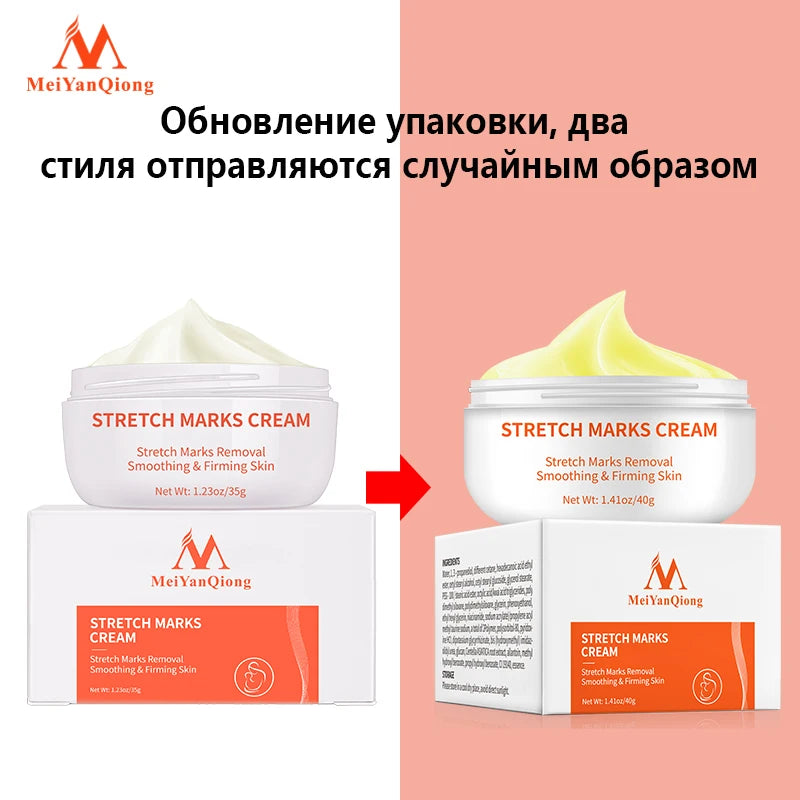 Pregnancy cream Removes Maternal Skin Repair Body Cream Removes Postpartum Scar Care Gentle Moisturizing Smooth skin