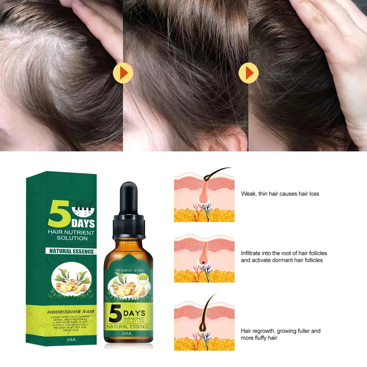 5 Days Ginger Hair Growth Oil Natural Anti Hair Loss Prevent Baldness Treatment Fast Growing Nourish Dry Damaged Hair Care