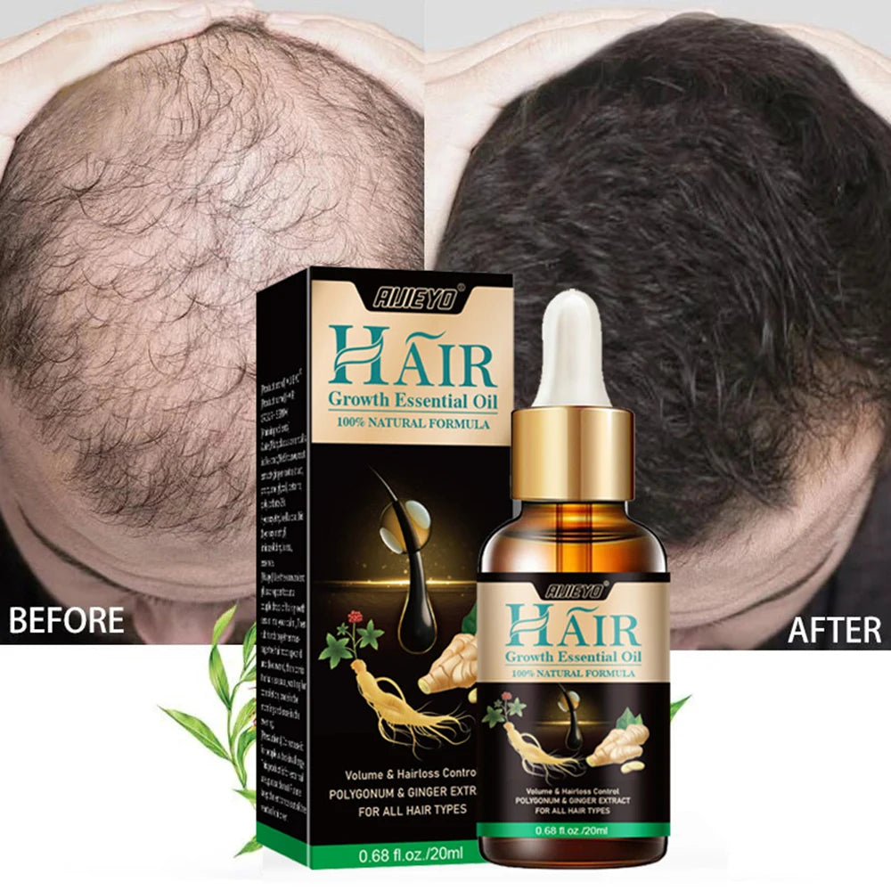 7 Days Ginger Hair Growth Products Natural Anti Hair Loss Prevent Baldness Treatment Fast Growing Nourish Dry Damaged Hair Care