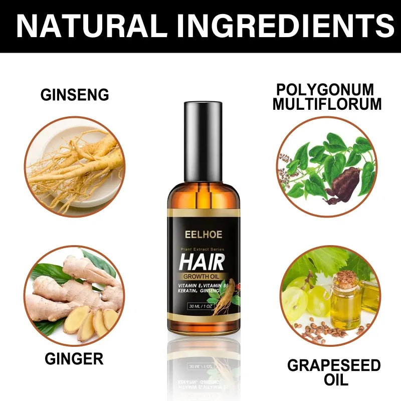 Ginger Hair Growth Spray Anti Hair Loss Serum Treatment Dry Frizzy Damaged Thin Hair Nourish Essential Oil Beauty Hair Care 30ml