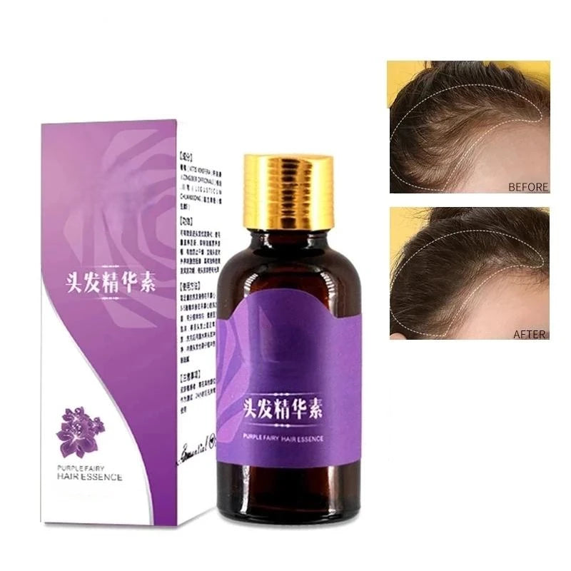 Hair Growth Products Ginger Fast Growing Hair Essential Oil Beauty Hair Care Prevent Hair Loss Oil Scalp Treatment For Men Women