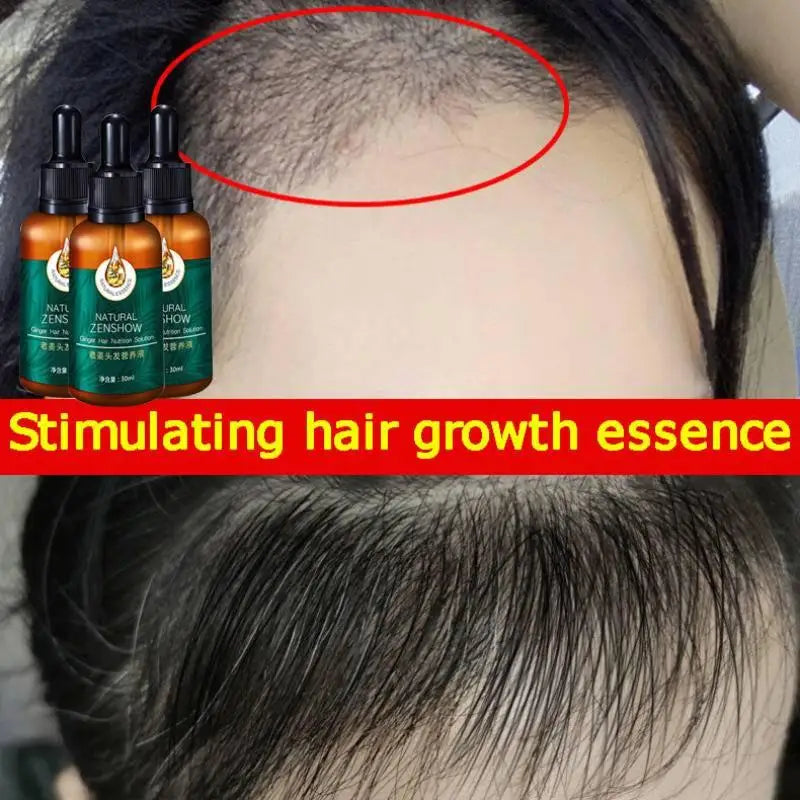 Rosemary Oil for Hair TRSTAY Ginger Hair Growth Essential Oil Herbal Care Anti-Hair Loss Repair Hair Follicles Stimulate