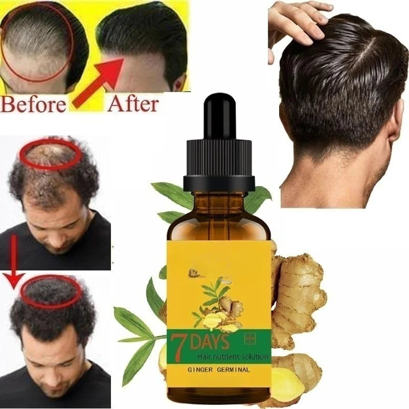 Hair Growth Serum In 7 Days Fast Hair Growth Natural Stop Hair Loss Treatment Products Hair Treatment for Hair Growth Set